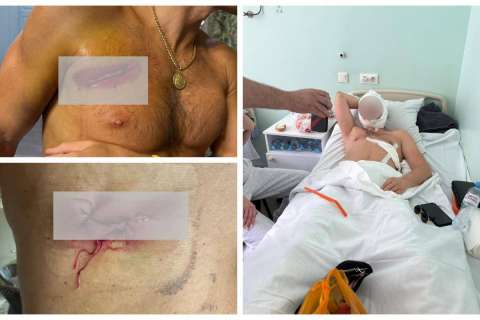 У одного из пострадавших в кровавой разборке у «Бархата» сегодня снимают швы, второй все еще находится в больнице