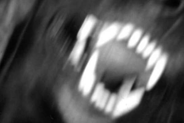 Воронежский суд оценил укусы собаки в 7 тысяч рублей Воронежский суд оценил укусы собаки в 7 тысяч рублей