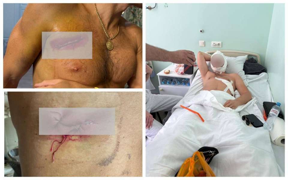 У одного из пострадавших в кровавой разборке у «Бархата» сегодня снимают швы, второй все еще находится в больнице