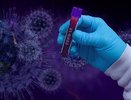 В Воронеже начнут проводить окончательные тесты на коронавирус