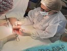 Воронежские хирурги восстановили кисть пациенту после несчастного случая