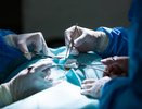 Воронежские онкологи спасли 60-летнего пациента с растущей наружу опухолью