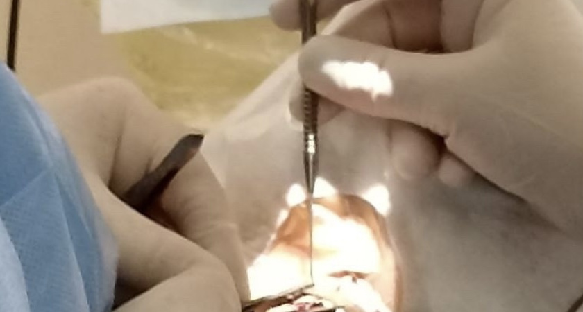 Офтальмологи ВОКОБ вылечили мужчину, более двадцати лет жившего с косоглазием