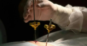 Воронежские хирурги восстановили позвоночник пациентки с помощью квадропластики