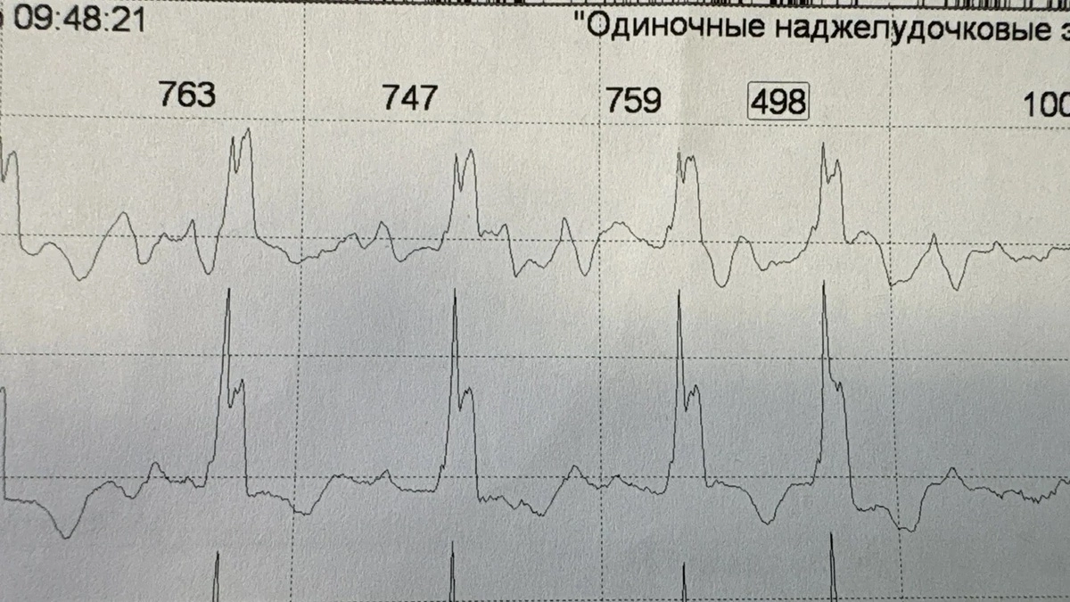 Смертельно опасную «мужскую» болезнь нашли воронежские медики у пенсионерки
